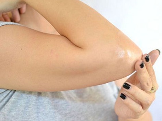 خلطات منزلية للتخلص من تصبّغات الكوع والركبة