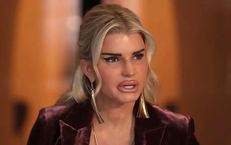 جسيكا سيمبسون بملامح مختلفة كلياً هل خضعت للتجميل؟